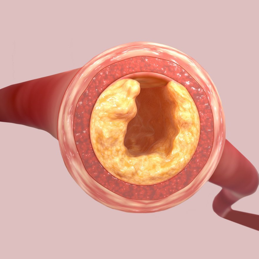 Cholesterol